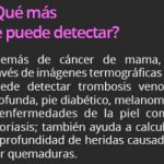 Termografía para detección de cáncer de mama