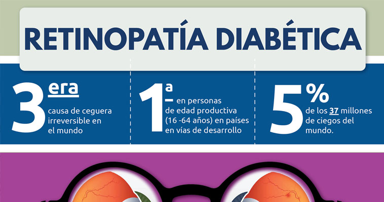 Retinopatía diabética estadísticas Retinopatía diabética estadísticas