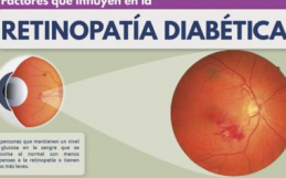 Factores que influyen en la retinopatía diabética