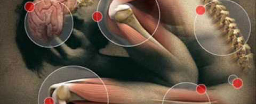 Afectan fibromialgia y síndrome de  fatiga crónica más a mujeres que a hombres