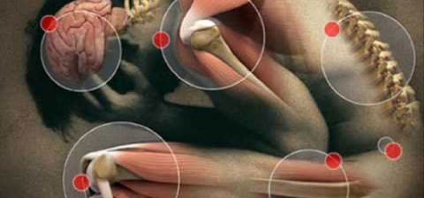 Afectan fibromialgia y síndrome de  fatiga crónica más a mujeres que a hombres