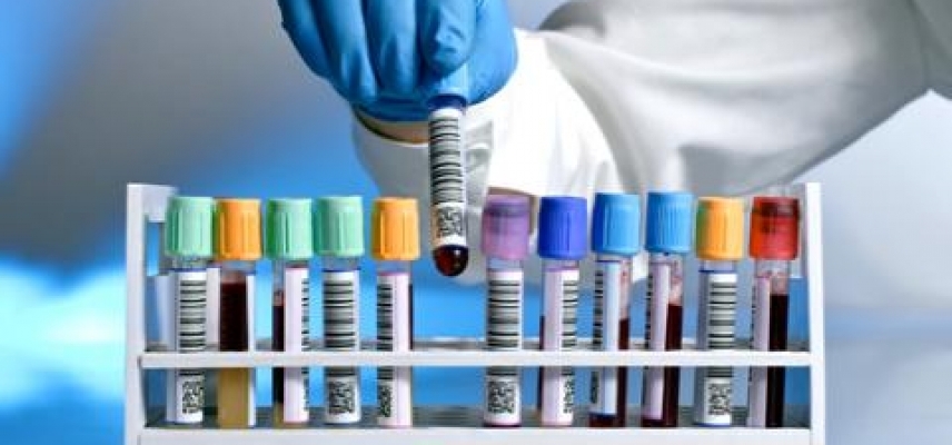 Aumenta 30% demanda de estudios médicos en unidades de detección oportuna