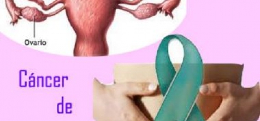 Cáncer de Ovario en el Seguro Popular