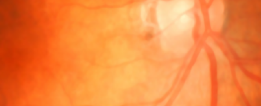 Diabetes y salud ocular