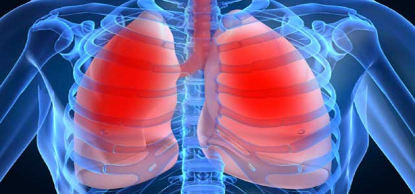 Día Mundial de la Hipertensión Pulmonar