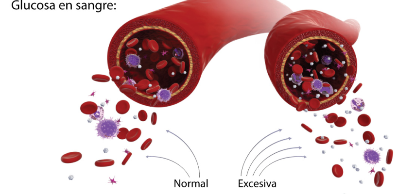 Factores que afectan su nivel de glucosa en la sangre
