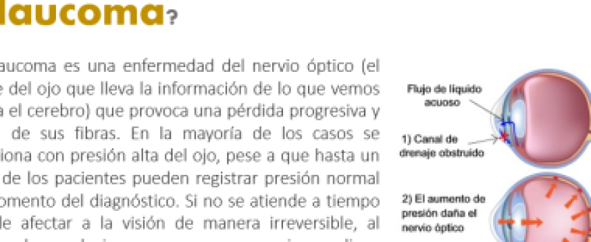 Glaucoma