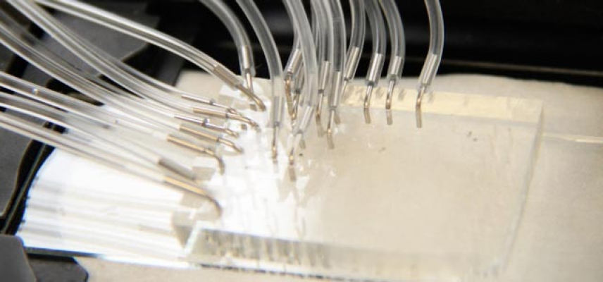 Biochip para pacientes con lupus