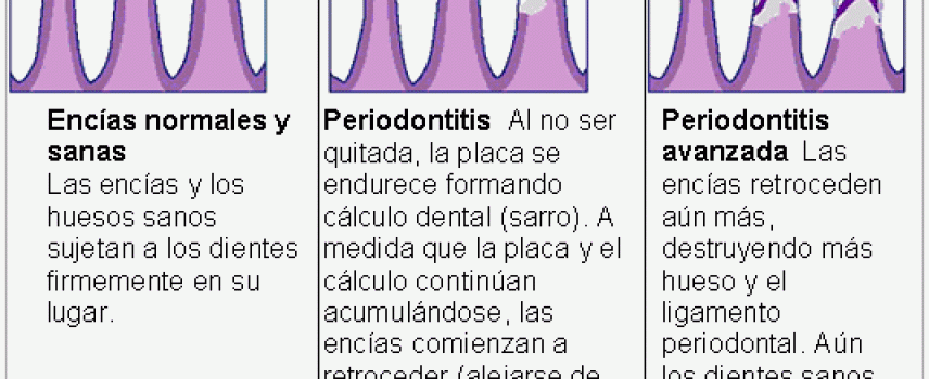 Cuidados dentales en la diabetes