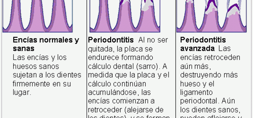 Cuidados dentales en la diabetes