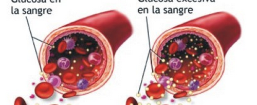 Niveles altos de glucosa en sangre