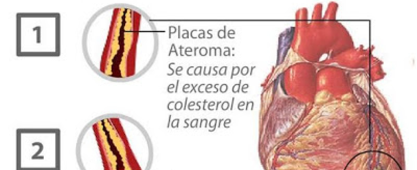 Cardiólogos mexicanos demandan acciones enérgicas del gobierno  para frenar muertes por infartos ligados al consumo de alimentos y bebidas “chatarra”