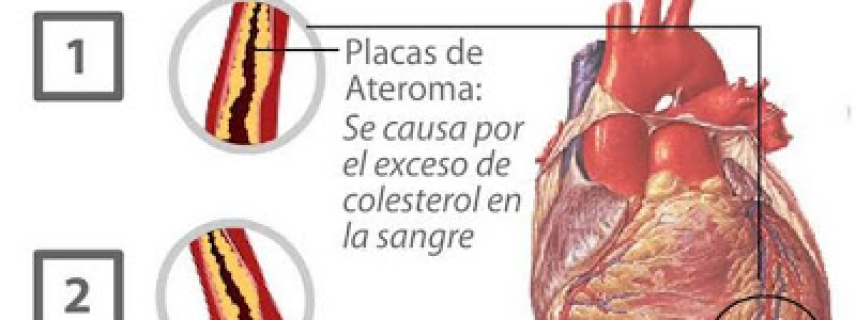 Cardiólogos mexicanos demandan acciones enérgicas del gobierno  para frenar muertes por infartos ligados al consumo de alimentos y bebidas “chatarra”