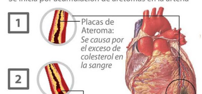 Cardiólogos mexicanos demandan acciones enérgicas del gobierno  para frenar muertes por infartos ligados al consumo de alimentos y bebidas “chatarra”