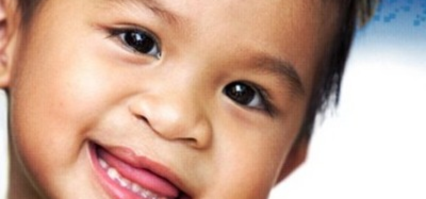 Recaudando fondos en beneficio de niños con labio/paladar hendido