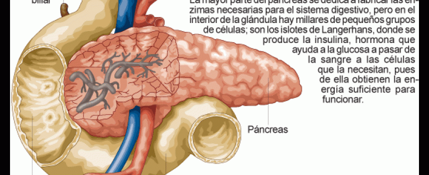 Impresión 3D ayuda para la diabetes tipo 1