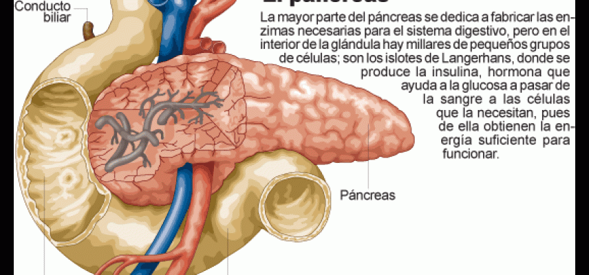 Impresión 3D ayuda para la diabetes tipo 1